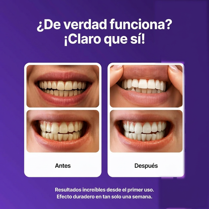 Dent.Lab™ Tiras Blanqueadoras Moradas
